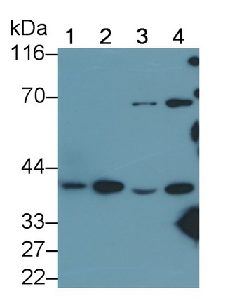 Polyclonal Antibody to Phosphoserine Aminotransferase 1 (PSAT1)