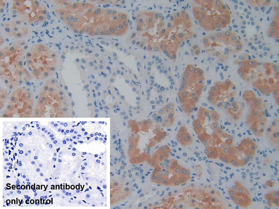 Polyclonal Antibody to Phosphoserine Aminotransferase 1 (PSAT1)