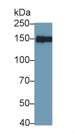 Polyclonal Antibody to Insulin Receptor Substrate 2 (IRS2)