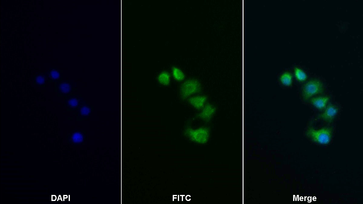 Polyclonal Antibody to Insulin Receptor Substrate 2 (IRS2)