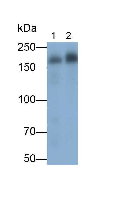 Polyclonal Antibody to Insulin Receptor Substrate 2 (IRS2)