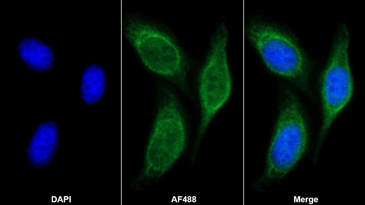 Polyclonal Antibody to Insulin Receptor Substrate 2 (IRS2)