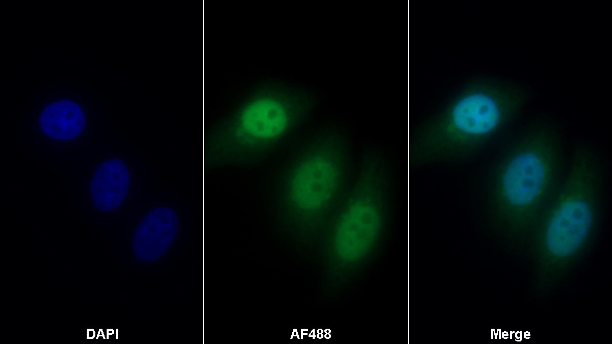 Polyclonal Antibody to General Transcription Factor IIH, Polypeptide 5 (GTF2H5)