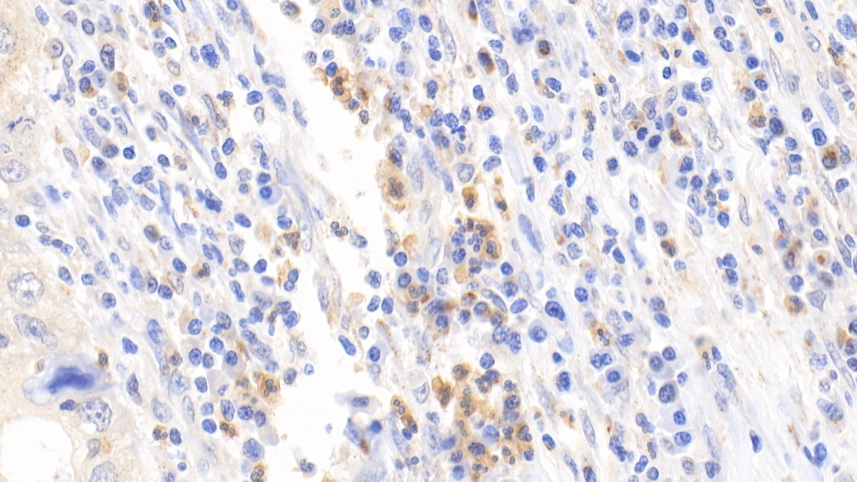 Polyclonal Antibody to Dipeptidyl Peptidase 3 (DPP3)