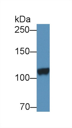 Polyclonal Antibody to Dipeptidyl Peptidase 6 (DPP6)