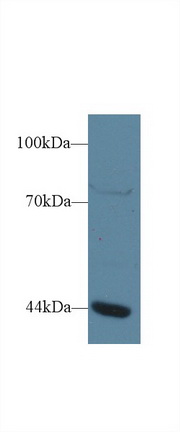 Polyclonal Antibody to General Transcription Factor IIIA (GTF3A)