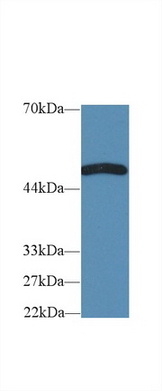 Polyclonal Antibody to Tumor Necrosis Factor Receptor Superfamily, Member 19 Like Protein (TNFRSF19L)