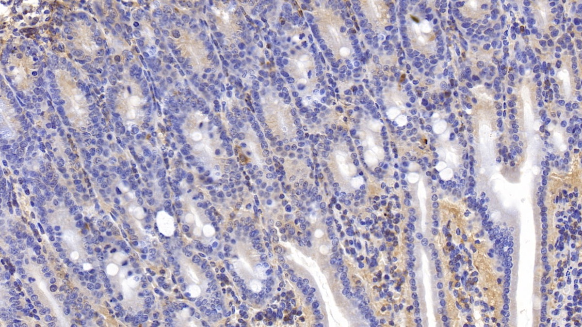 Polyclonal Antibody to Tumor Necrosis Factor Receptor Superfamily, Member 14 (TNFRSF14)