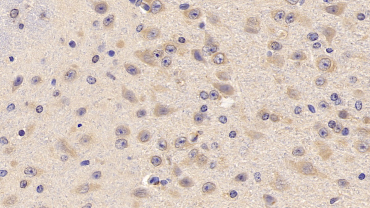 Polyclonal Antibody to Tumor Necrosis Factor Receptor Superfamily, Member 14 (TNFRSF14)