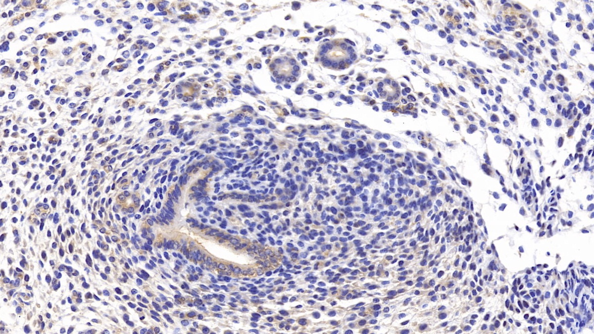 Polyclonal Antibody to Tumor Necrosis Factor Receptor Superfamily, Member 14 (TNFRSF14)