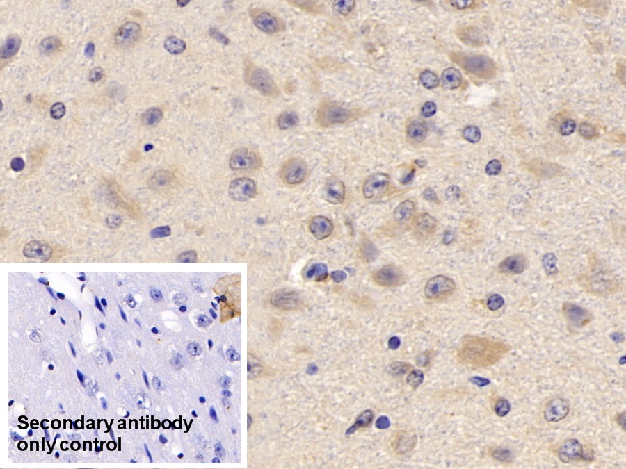 Polyclonal Antibody to Tumor Necrosis Factor Receptor Superfamily, Member 14 (TNFRSF14)