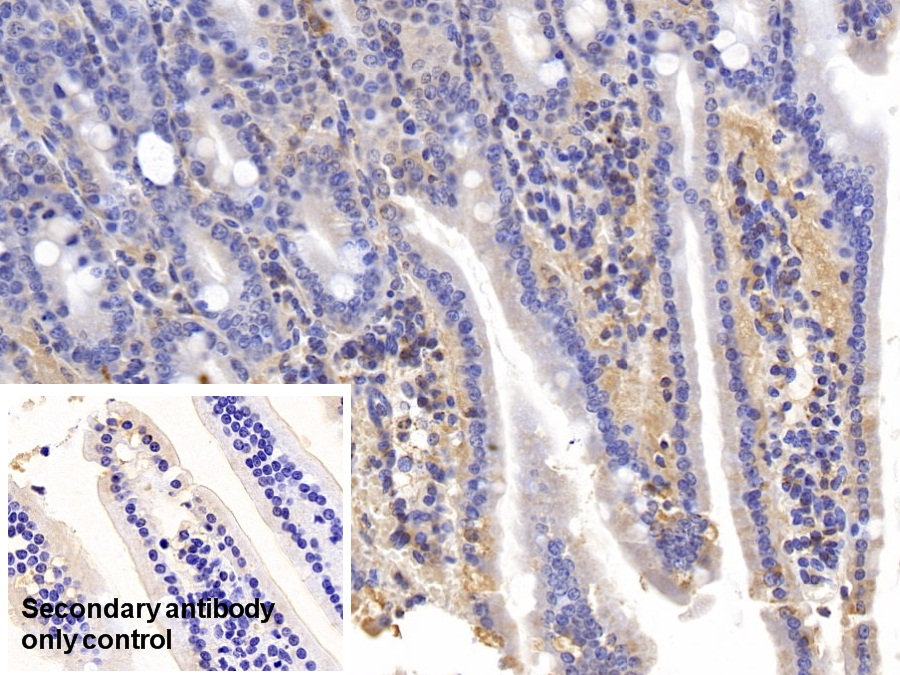 Polyclonal Antibody to Tumor Necrosis Factor Receptor Superfamily, Member 14 (TNFRSF14)