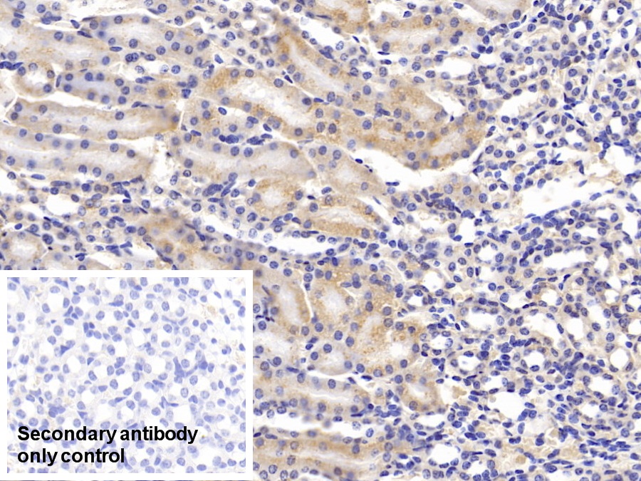 Polyclonal Antibody to Tumor Necrosis Factor Receptor Superfamily, Member 14 (TNFRSF14)