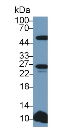 Polyclonal Antibody to Tumor Necrosis Factor Ligand Superfamily, Member 12 (TNFSF12)