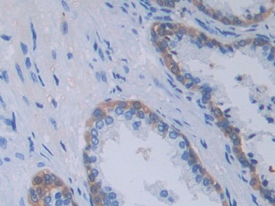 Polyclonal Antibody to Tumor Necrosis Factor Ligand Superfamily, Member 9 (TNFSF9)