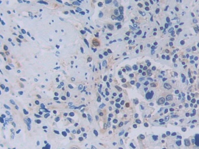 Polyclonal Antibody to Tumor Necrosis Factor Ligand Superfamily, Member 9 (TNFSF9)