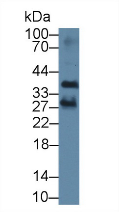 Polyclonal Antibody to Proteasome Assembly Chaperone 2 (PSMG2)