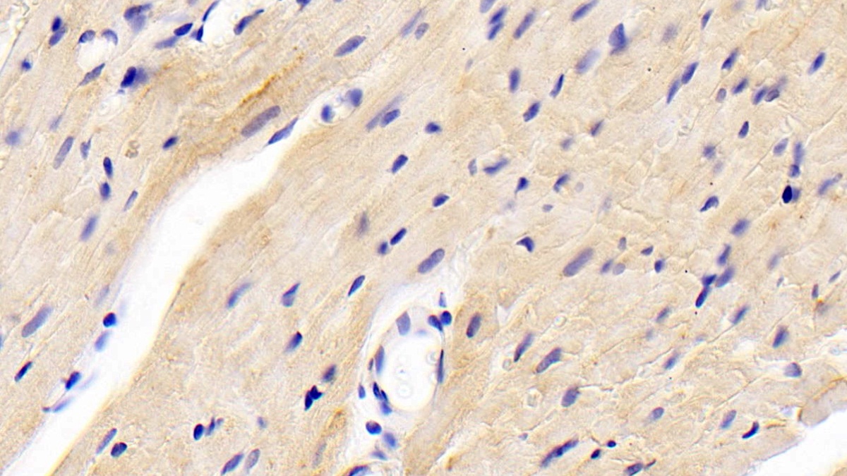 Polyclonal Antibody to 5'-Nucleotidase, Mitochondrial (NT5M)