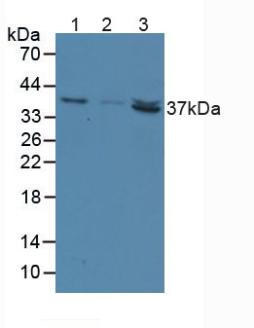 Polyclonal Antibody to 5'-Nucleotidase, Cytosolic III (NT5C3)