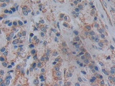 Polyclonal Antibody to 5'-Nucleotidase, Cytosolic III (NT5C3)