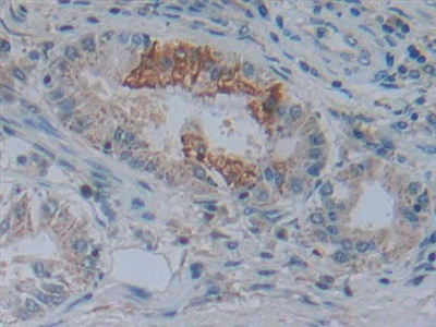 Polyclonal Antibody to 5'-Nucleotidase, Cytosolic III (NT5C3)