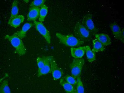 Polyclonal Antibody to 5'-Nucleotidase, Cytosolic III (NT5C3)