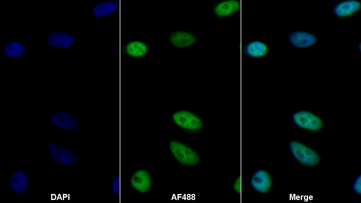 Polyclonal Antibody to RAR Related Orphan Receptor Gamma (RORg)