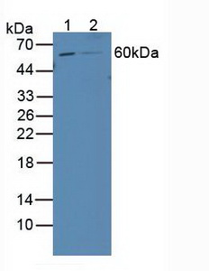 Polyclonal Antibody to Retinoic Acid Receptor Beta (RARb)