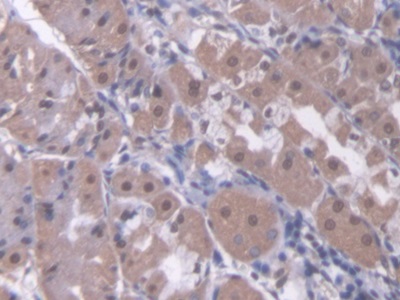 Polyclonal Antibody to Retinoic Acid Receptor Beta (RARb)