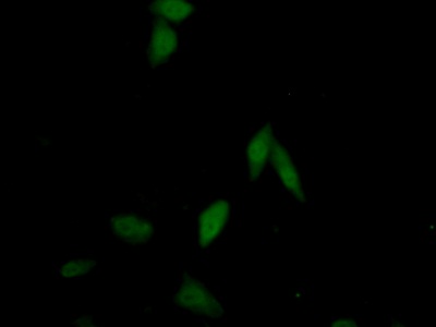 Polyclonal Antibody to Retinoic Acid Receptor Beta (RARb)