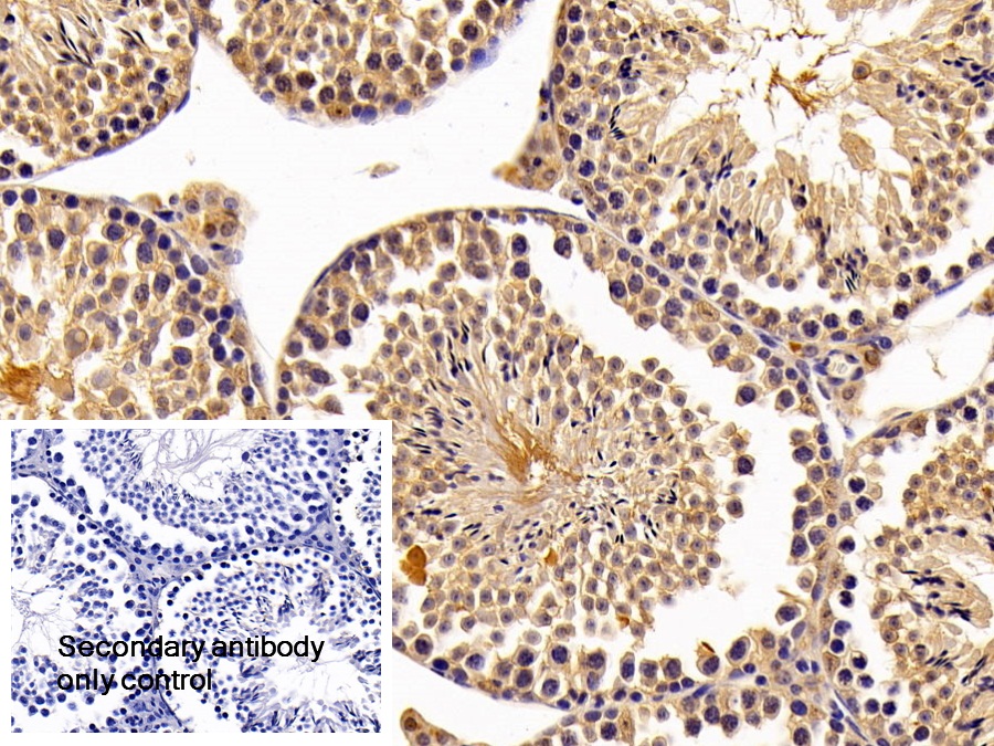 Polyclonal Antibody to Nuclear Receptor Subfamily 0, Group B, Member 1 (NR0B1)