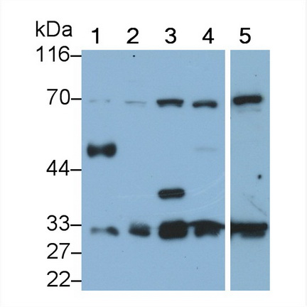 Polyclonal Antibody to Dimethylarginine Dimethylaminohydrolase 2 (DDAH2)