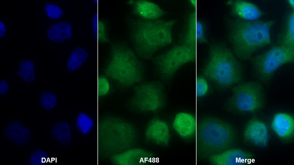 Polyclonal Antibody to Dimethylarginine Dimethylaminohydrolase 2 (DDAH2)