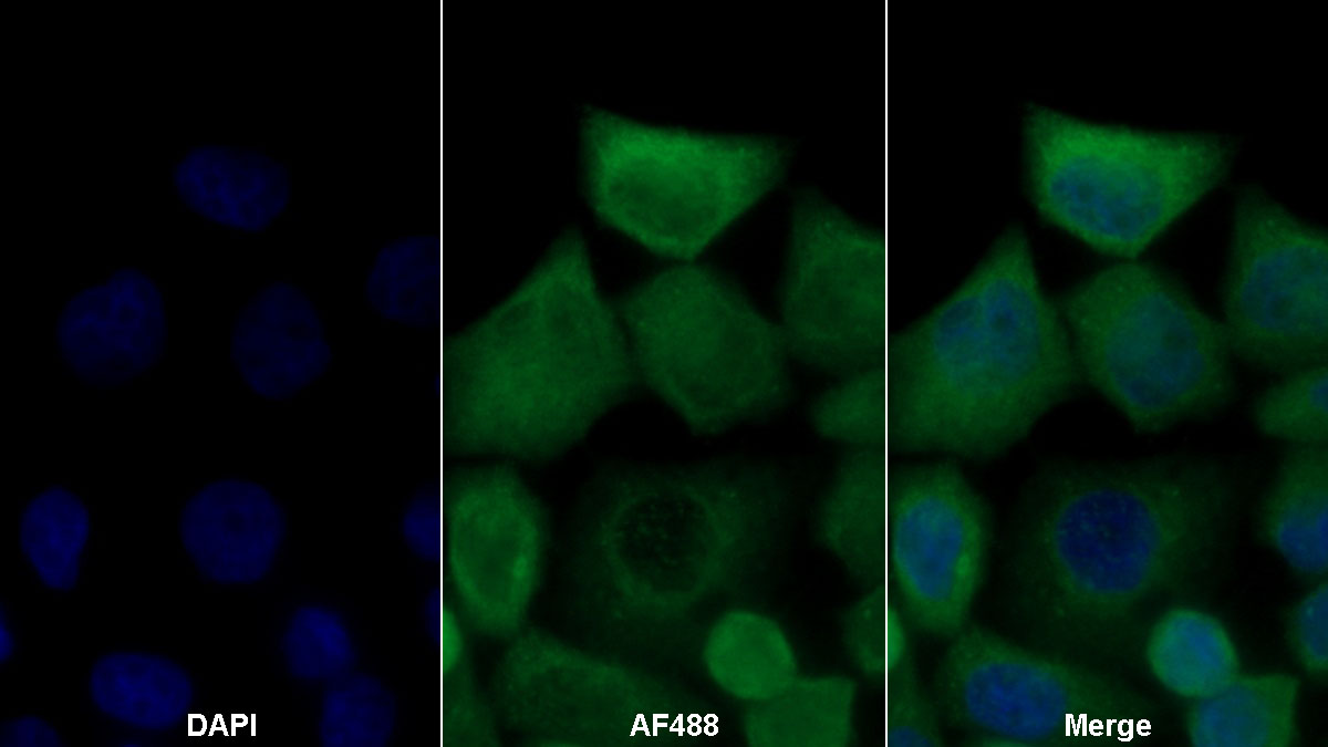 Polyclonal Antibody to Dimethylarginine Dimethylaminohydrolase 2 (DDAH2)