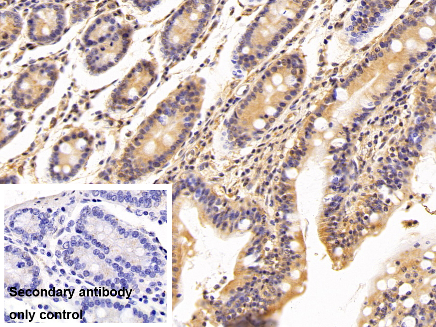 Polyclonal Antibody to Dimethylarginine Dimethylaminohydrolase 2 (DDAH2)