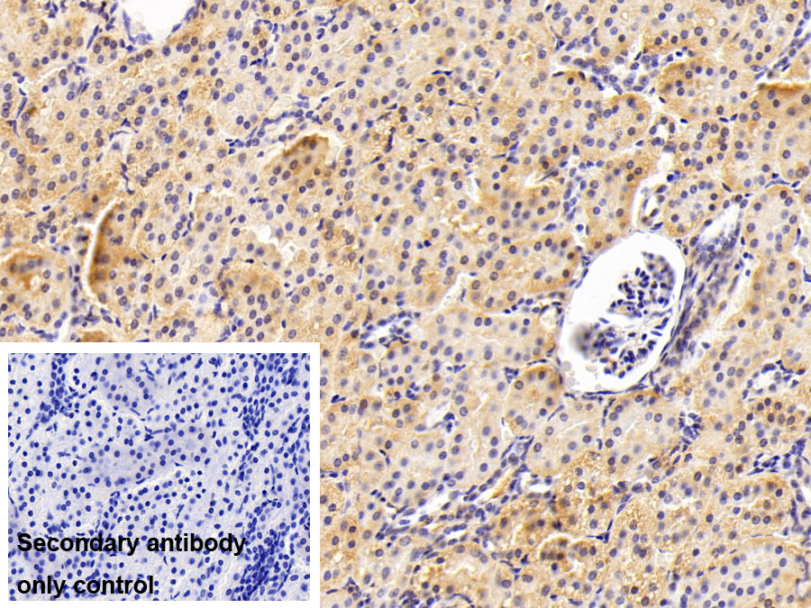 Polyclonal Antibody to Dimethylarginine Dimethylaminohydrolase 2 (DDAH2)