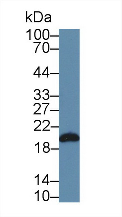 Polyclonal Antibody to Dimethylarginine Dimethylaminohydrolase 1 (DDAH1)