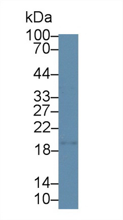 Polyclonal Antibody to Dimethylarginine Dimethylaminohydrolase 1 (DDAH1)