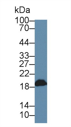 Polyclonal Antibody to Dimethylarginine Dimethylaminohydrolase 1 (DDAH1)