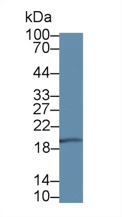 Polyclonal Antibody to Dimethylarginine Dimethylaminohydrolase 1 (DDAH1)