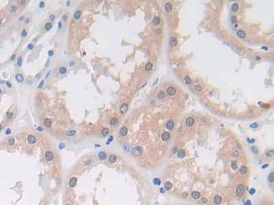 Polyclonal Antibody to Dimethylarginine Dimethylaminohydrolase 1 (DDAH1)