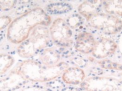 Polyclonal Antibody to Cathepsin G (CTSG)