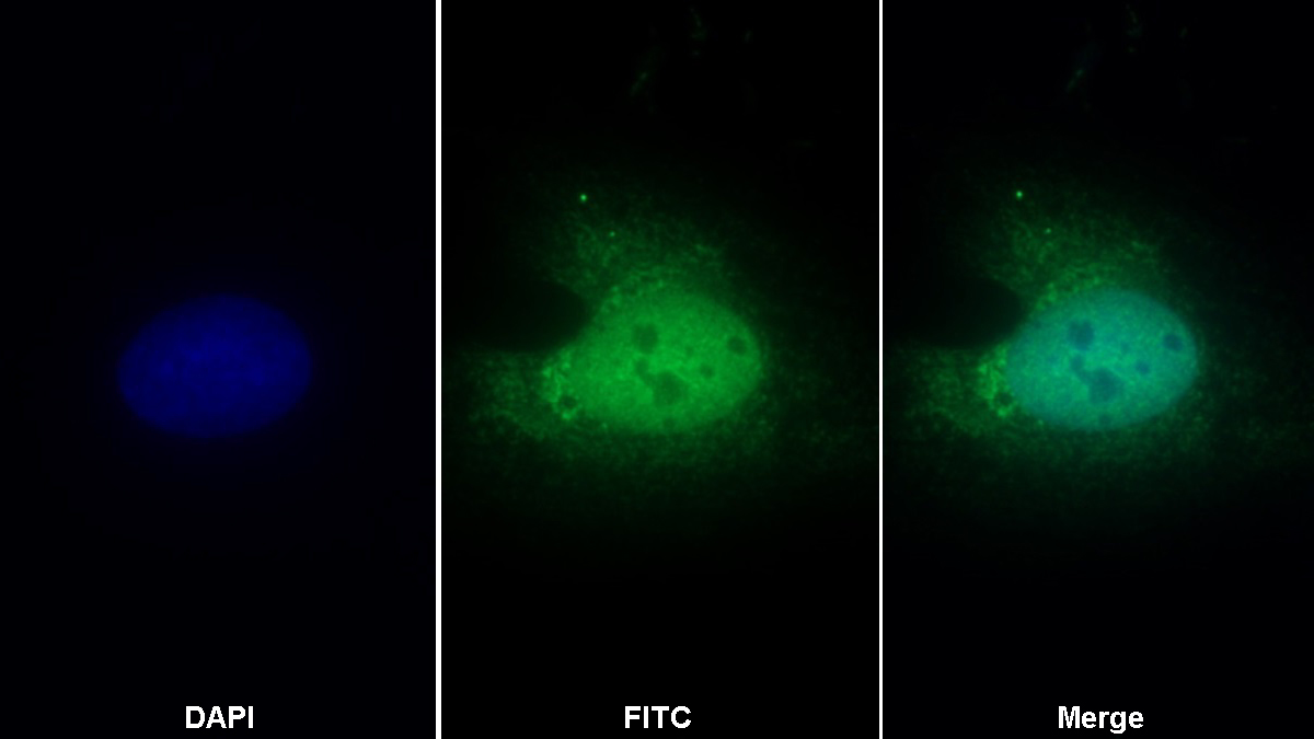 Polyclonal Antibody to Procollagen C Proteinase Enhancer 2 (PCPE2)