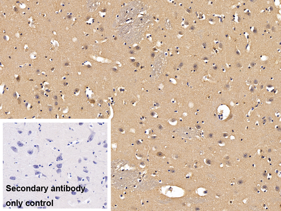 Polyclonal Antibody to Procollagen C Proteinase Enhancer 2 (PCPE2)