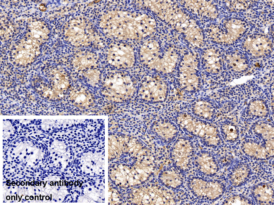 Polyclonal Antibody to Procollagen C Proteinase Enhancer 2 (PCPE2)