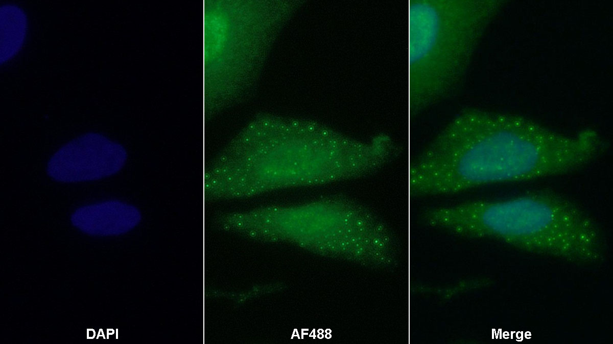 Polyclonal Antibody to CREB Regulated Transcription Coactivator 3 (CRTC3)