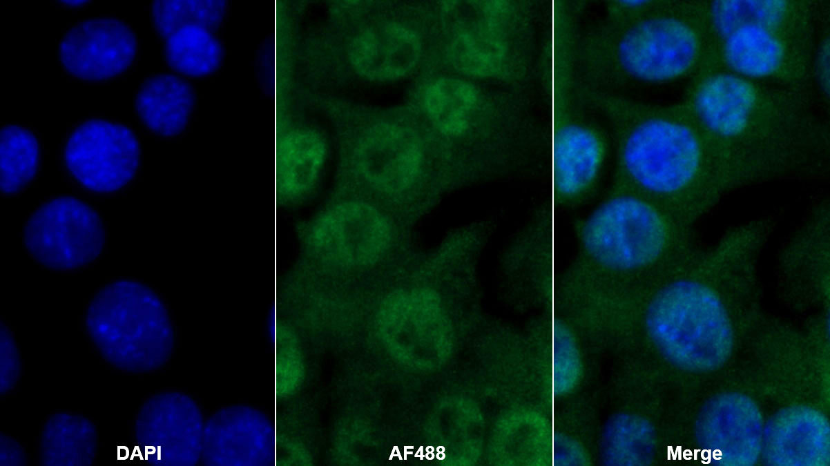 Polyclonal Antibody to CREB Binding Protein (CREBBP)