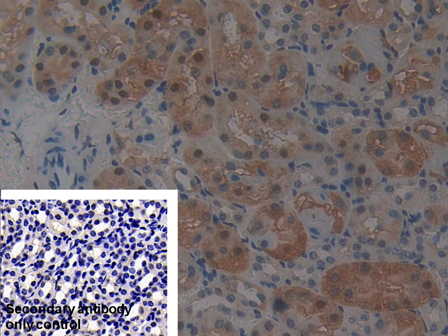 Polyclonal Antibody to Protein Phosphatase 2A Activator, Regulatory Subunit 4 (PPP2R4)