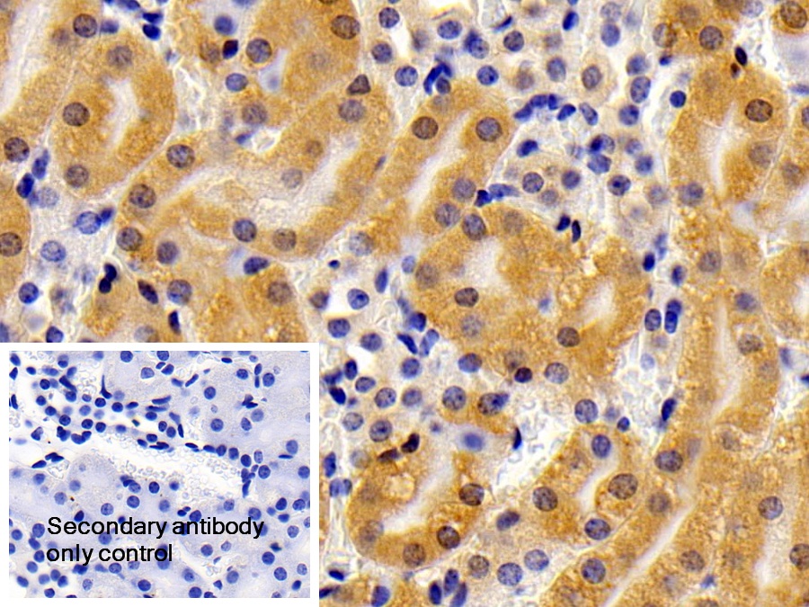 Polyclonal Antibody to Calcineurin Like Phosphoesterase Domain Containing Protein 1 (CPPED1)