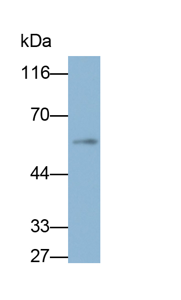 Polyclonal Antibody to Protein Phosphatase 3, Catalytic Subunit Beta Isoform (PPP3Cb)